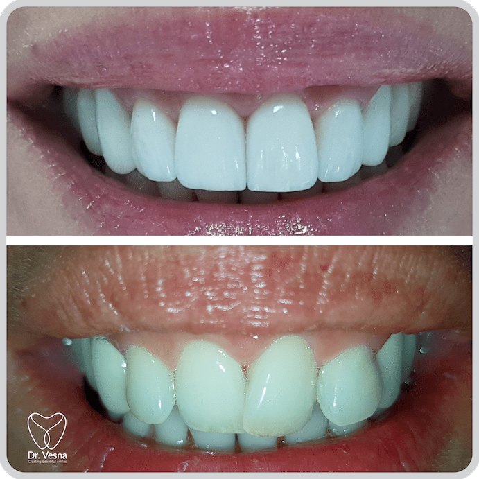Dr Vesna Dentistry Dubai – Top Cosmetic and General Dentist