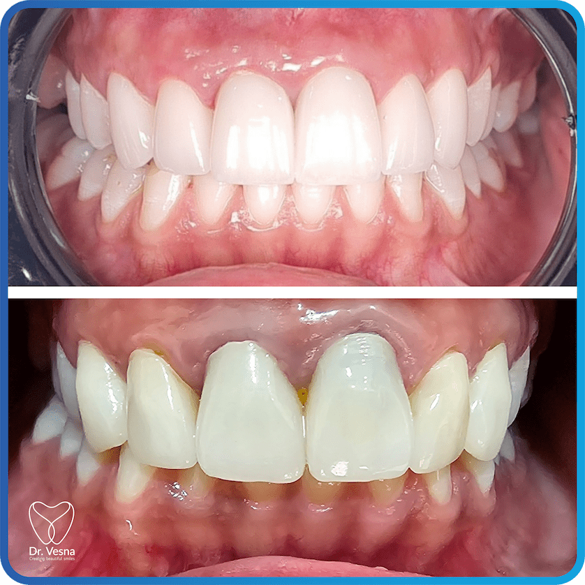 Dr Vesna Dentistry Dubai – Top Cosmetic and General Dentist