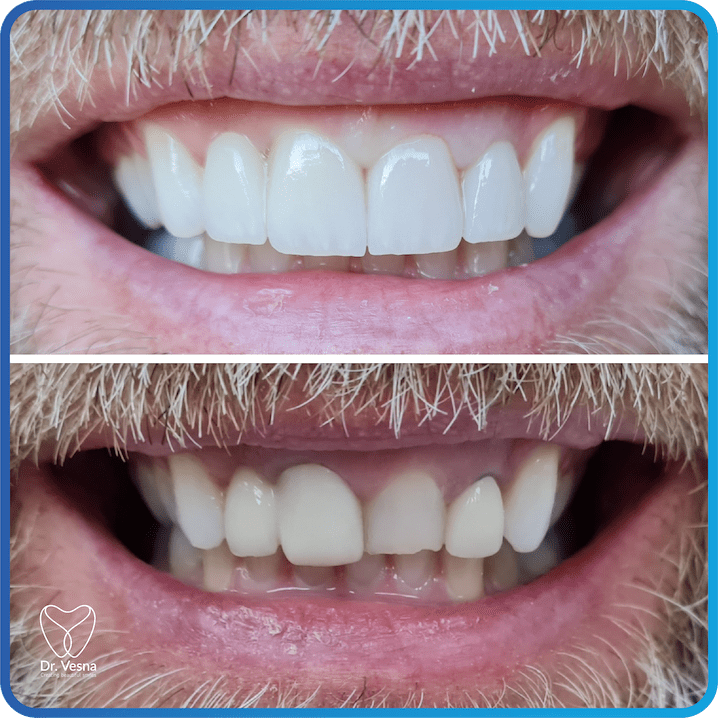Dr Vesna Dentistry Dubai – Top Cosmetic and General Dentist