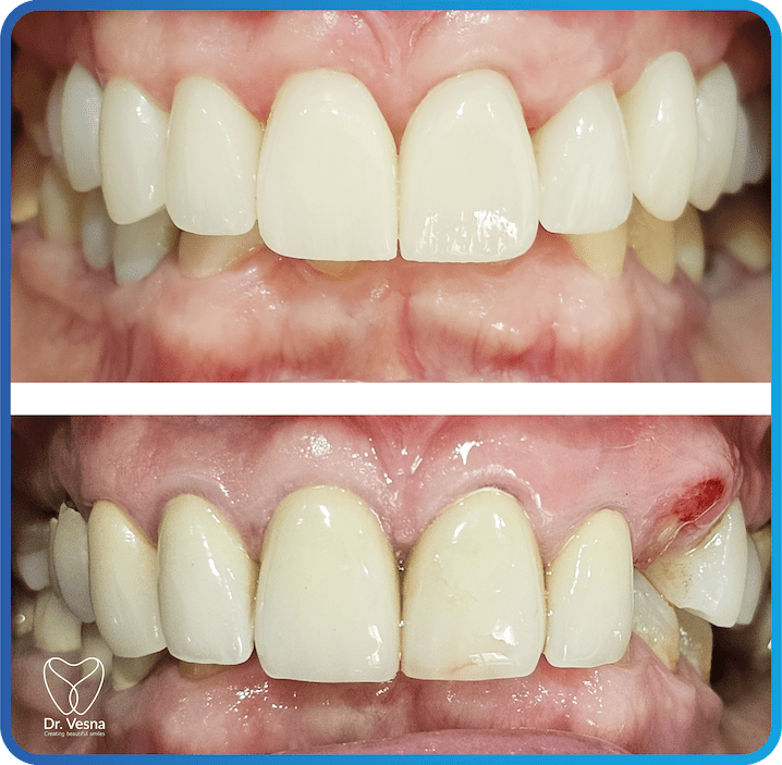 Dr Vesna Dentistry Dubai – Top Cosmetic and General Dentist