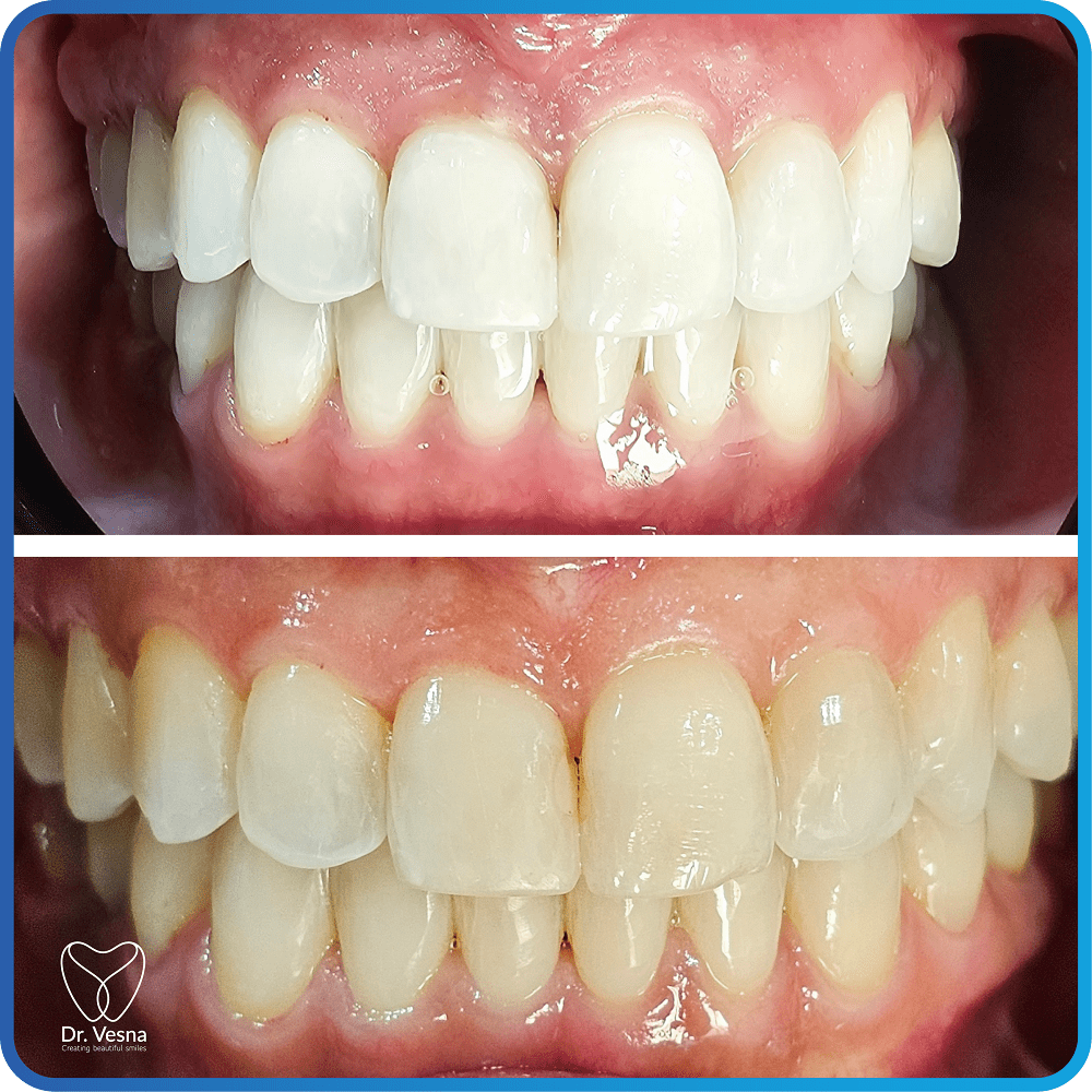 Dr Vesna Dentistry Dubai – Top Cosmetic and General Dentist