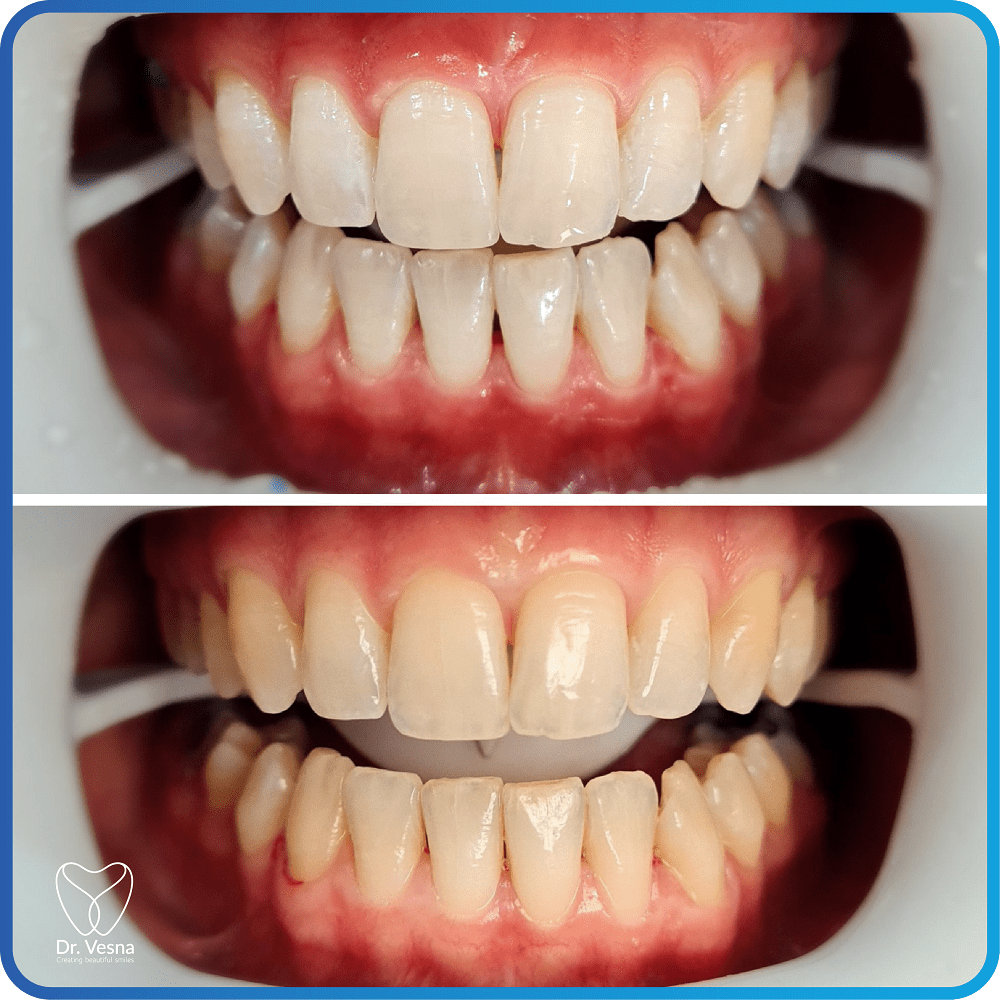 Dr Vesna Dentistry Dubai – Top Cosmetic and General Dentist
