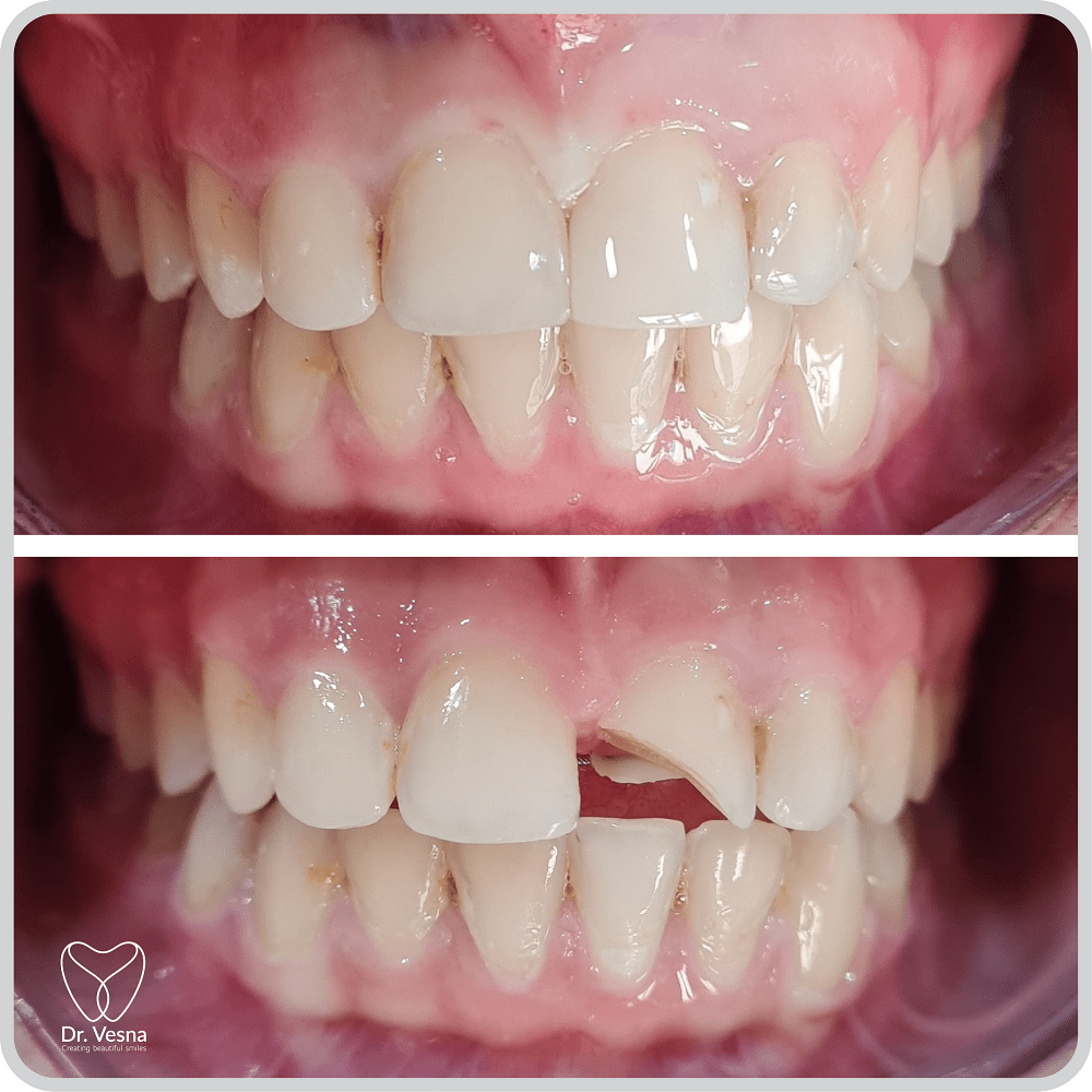 Dr Vesna Dentistry Dubai – Top Cosmetic and General Dentist