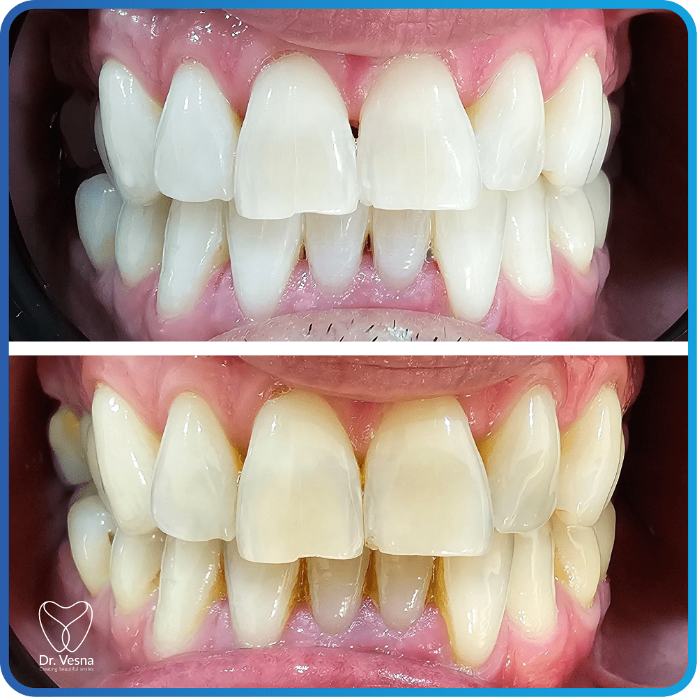 Dr Vesna Dentistry Dubai – Top Cosmetic and General Dentist