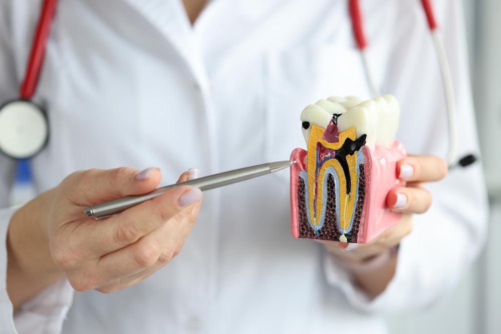 Root Canal Treatment Dubai | Save Your Natural Tooth