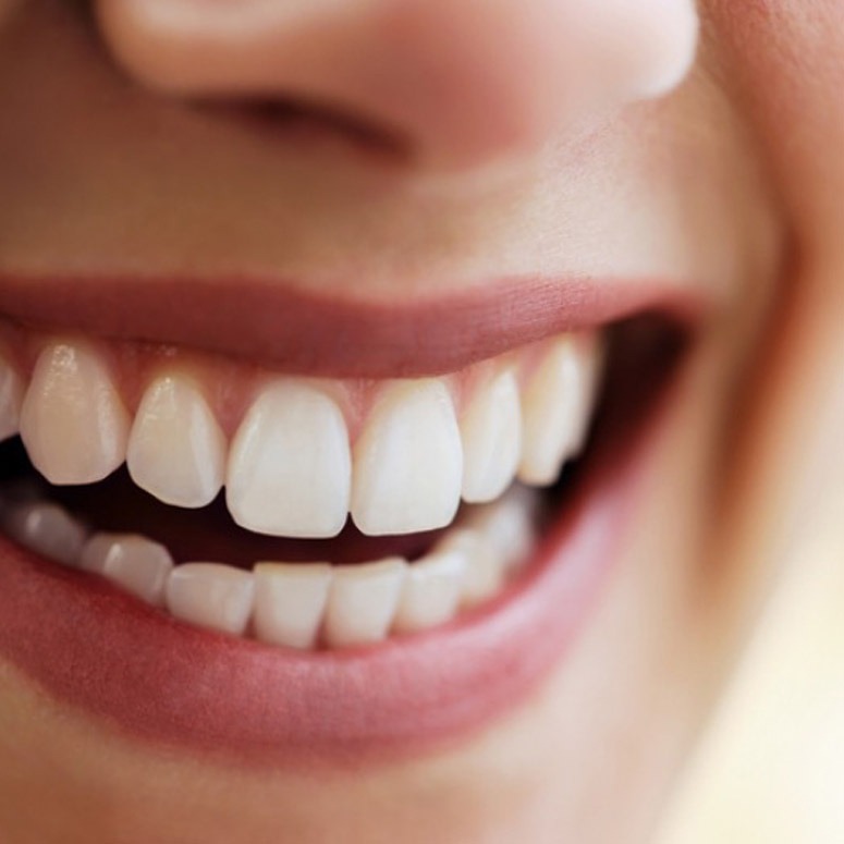 Dr Vesna Dentistry Dubai – Top Cosmetic and General Dentist